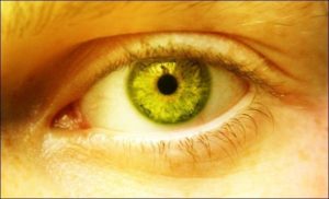 why eyes could be yellow